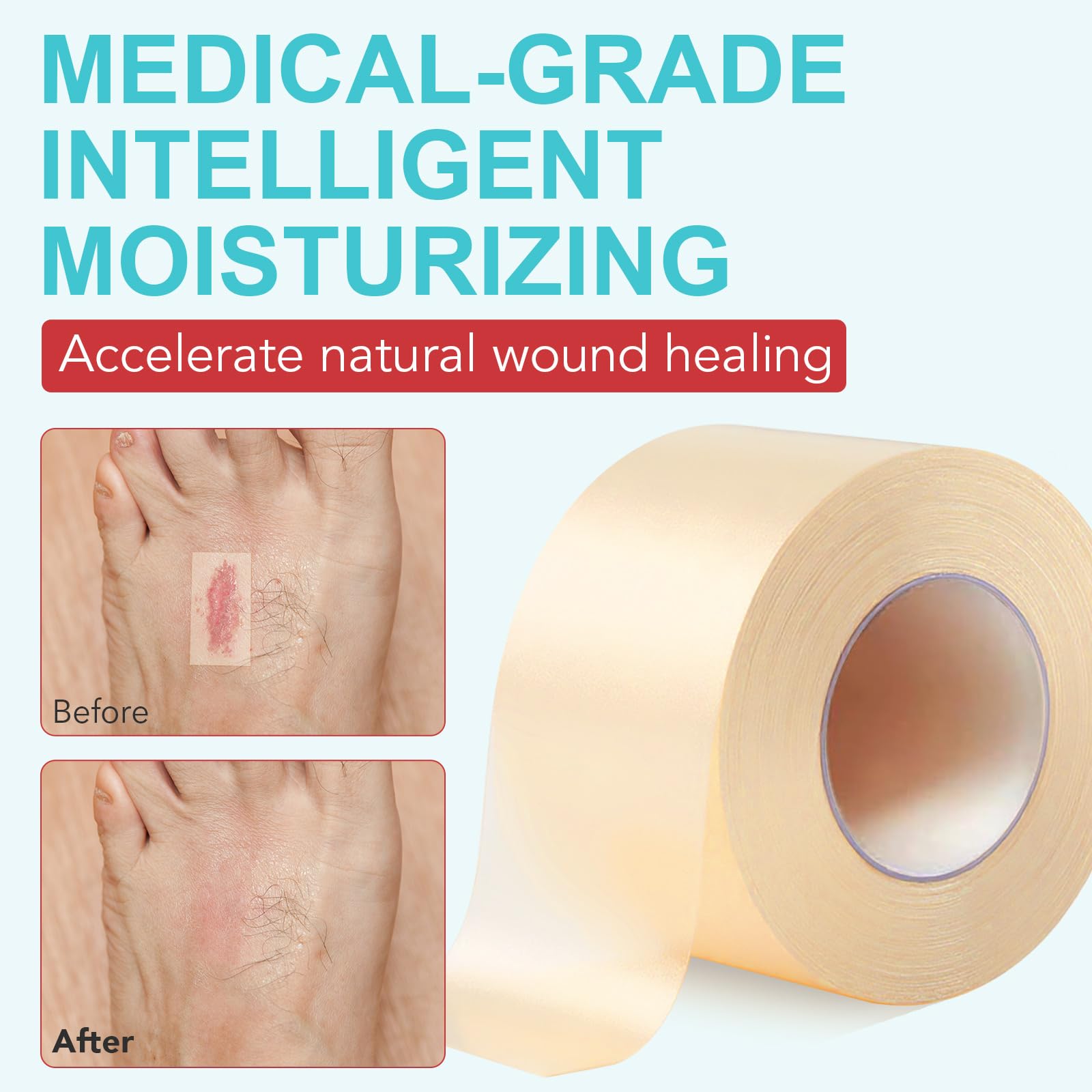 Apósitos Hidrocoloides Rollo 5cm x 360cm, Vendas Impermeables para Heridas con Exudado Leve, Ampollas y Acné, Gel Hidrocoloide Transpirable y Cortable a Medida