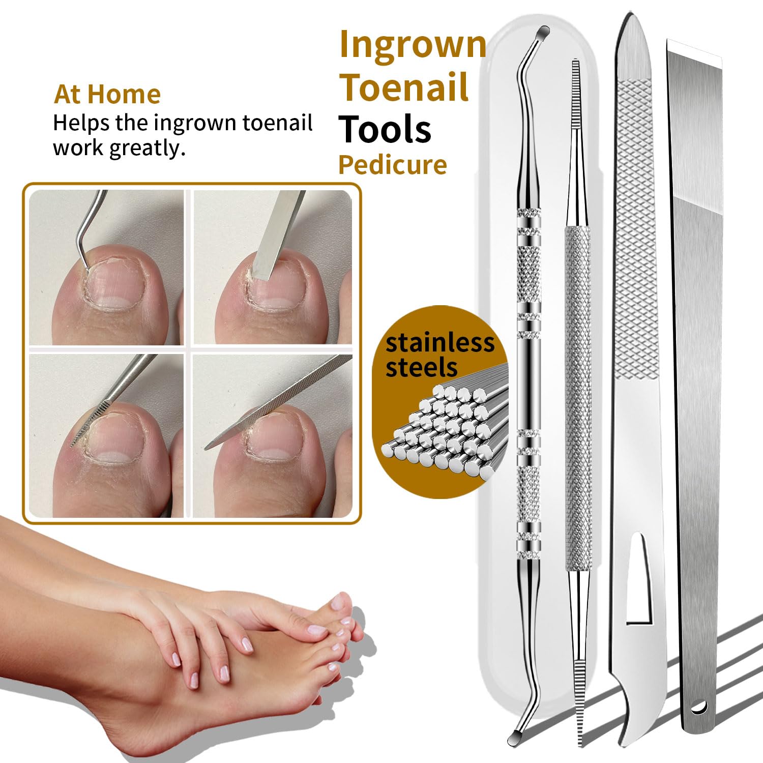 EBEWANLI Kit d'enlèvement d'ongle incarné, 6 pièces en acier inoxydable, kit pour ongles d'orteil avec coupe-ongles droits, obliques et incurvés pour ongles incarnés, outil de pédicure professionnel à