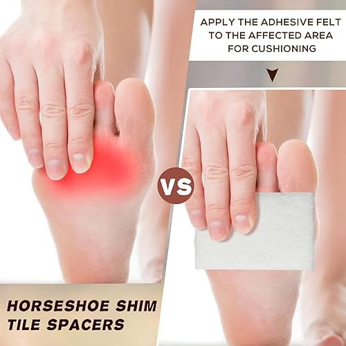 Miniatura 4 de Jecery Rollo de fieltro adhesivo de 14 x 6 x 2.5 yardas, acolchado y ortopédico para amortiguación de heridas, 1 rollo (blanco)