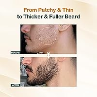 Vista 6 de NOURISH MANTRA - Suero avanzado de aceite para el crecimiento de la barba Fabricado con Redensyl, Capilia Longa, aceite de argán, vitamina E