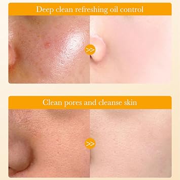 Vitamin C Foaming Face Cleanser Women with Silicone Brush,- Gentle Facial Cleanser For Dry Skin & Oily Skin, Face Wash Women & Men for Deep Cleansing, Hydrating,and Skin Exfoliation, Daily Face Care