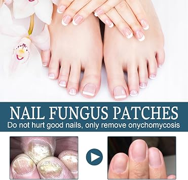 MAXIMUM Strength Nail Fungal Treatment - Toenail & Fingernail Fungus Eliminator - Repair, Strengthen, Fix & Renew Damaged Nails - 30ml