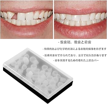 Amazon.co.jp: ShuaWdk 義歯 仮歯冠 歯科用仮歯キット 歯科材料 前歯と