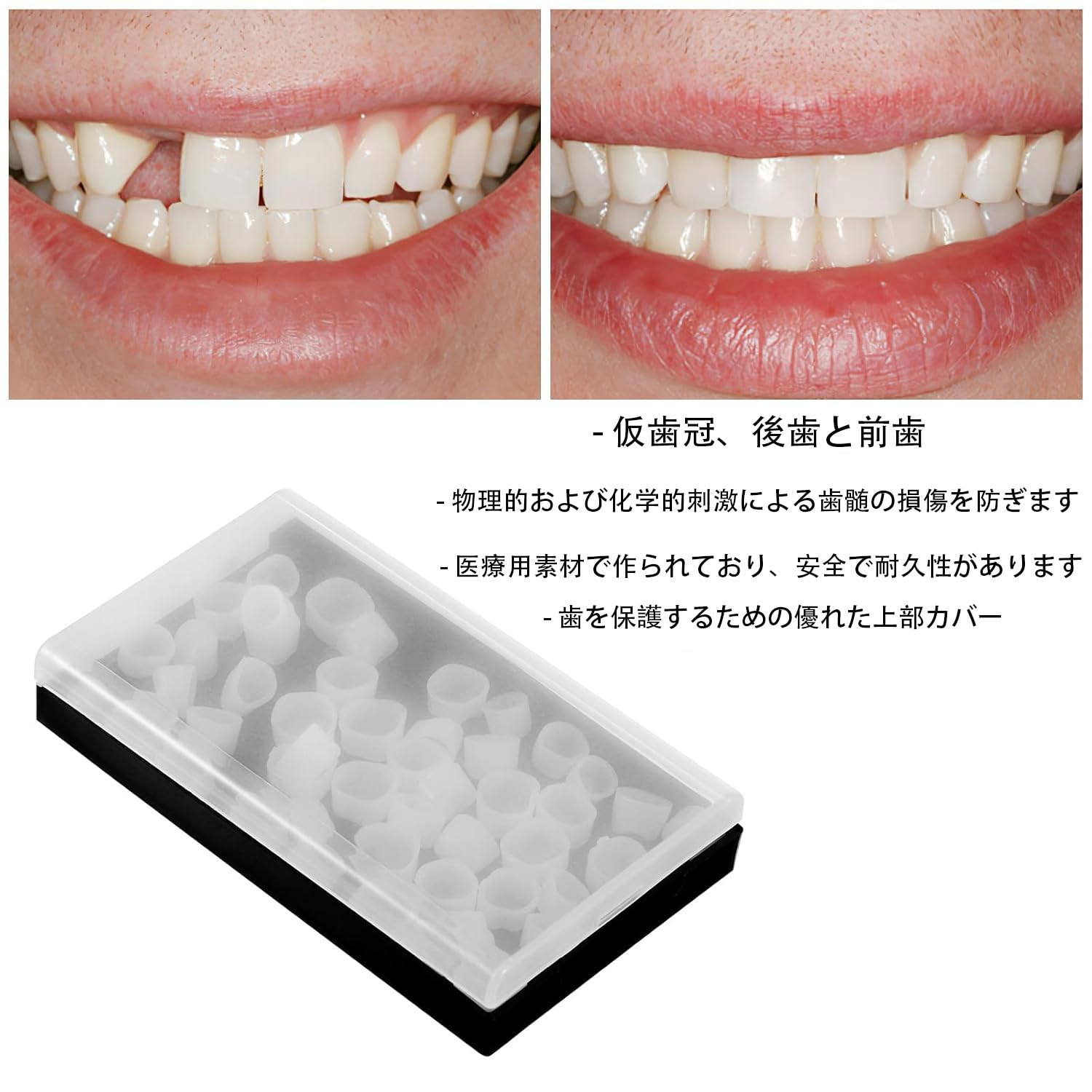 Amazon.co.jp: ShuaWdk 義歯 仮歯冠 歯科用仮歯キット 歯科材料 前歯と