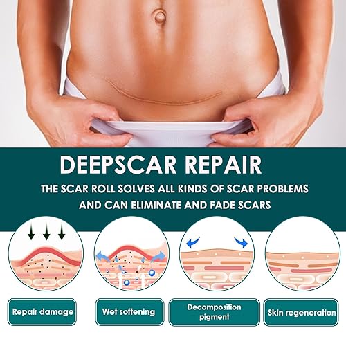 Miniatura 4 de Cinta de silicona para cicatrices, láminas de gel de silicona premium (rollo de 1.6 x 60 pulgadas - 4.9 ft), parches de silicona reutilizables,