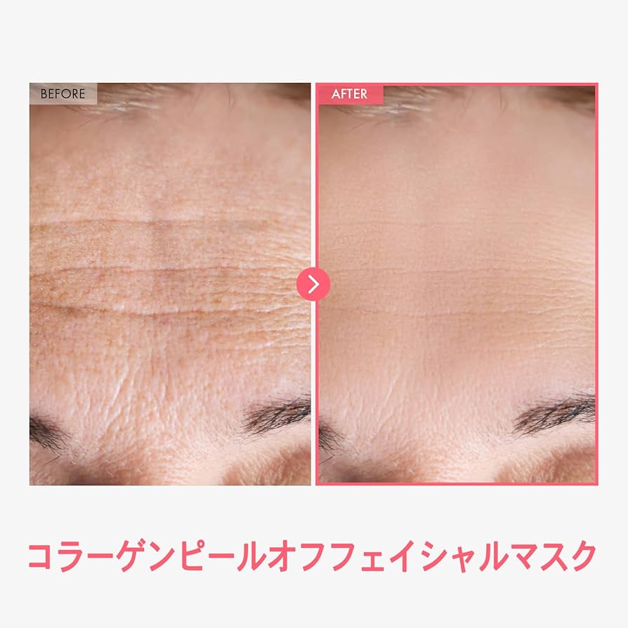 【関東の方限定⠀】コラーゲンマシン コラーゲンマシン・コラーゲンライトのお問い合わせは三宏商会へ