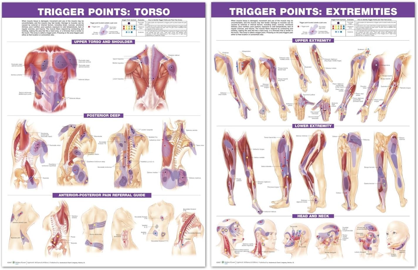 Trigger Point Chart Set Torso and Extremities 2nd Edition Laminated