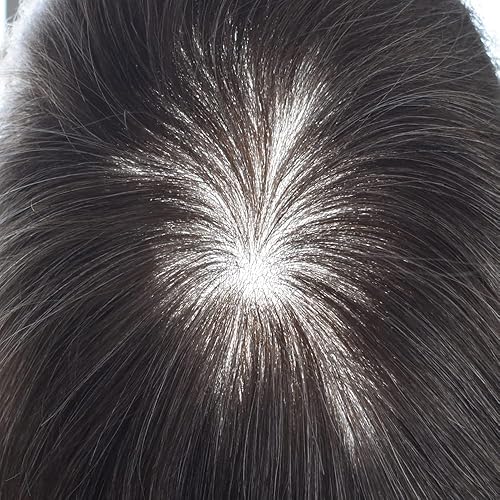 Miniatura 4 de Healthlif Toupee para hombres Pieza de pelo ultrafina para piel Toupee Men Sistema de cabello humano con bucle en V para hombres Unidad de cabello