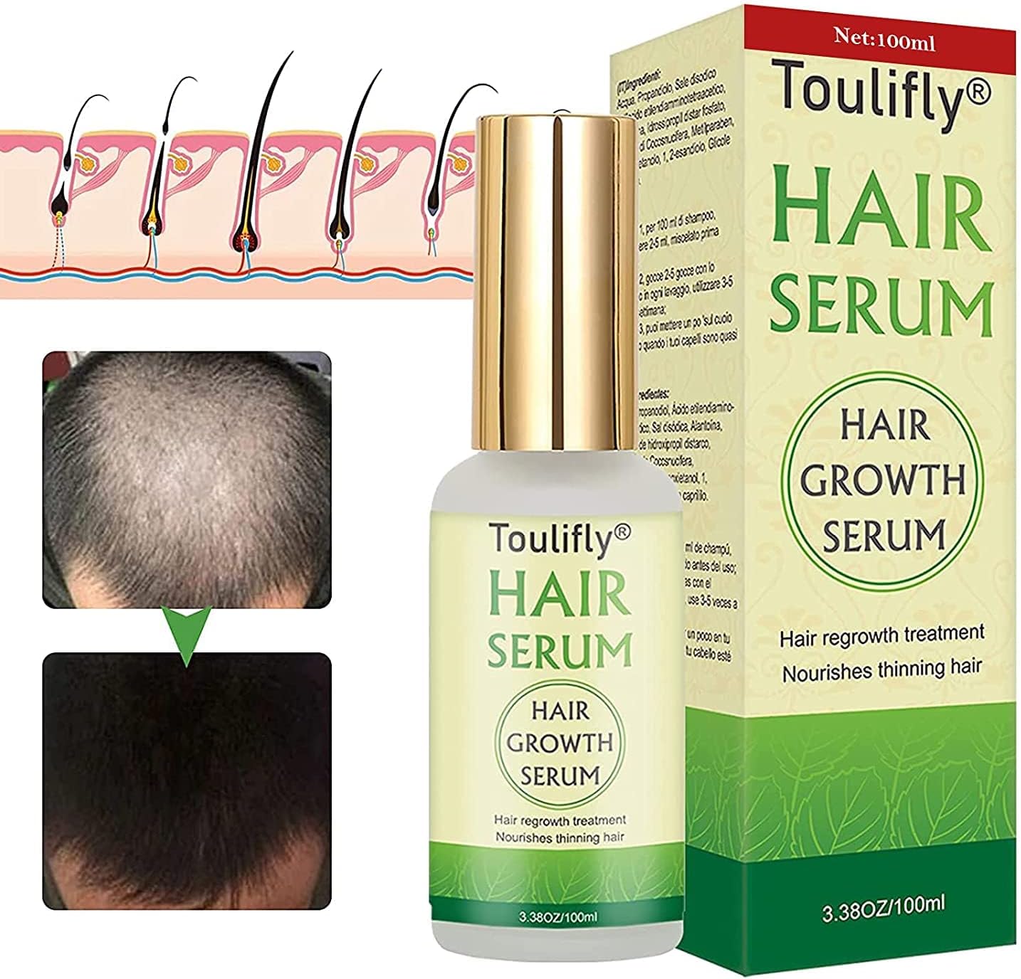 Hair Growth Serum, Hair Loss and Hair Thinning Treatment, Stops Hair Loss, Natural Herbal Essence,Thinning, Balding, Repairs Hair Follicles, Promotes Thicker, Stronger Hair and New Hair Growth(50ml)