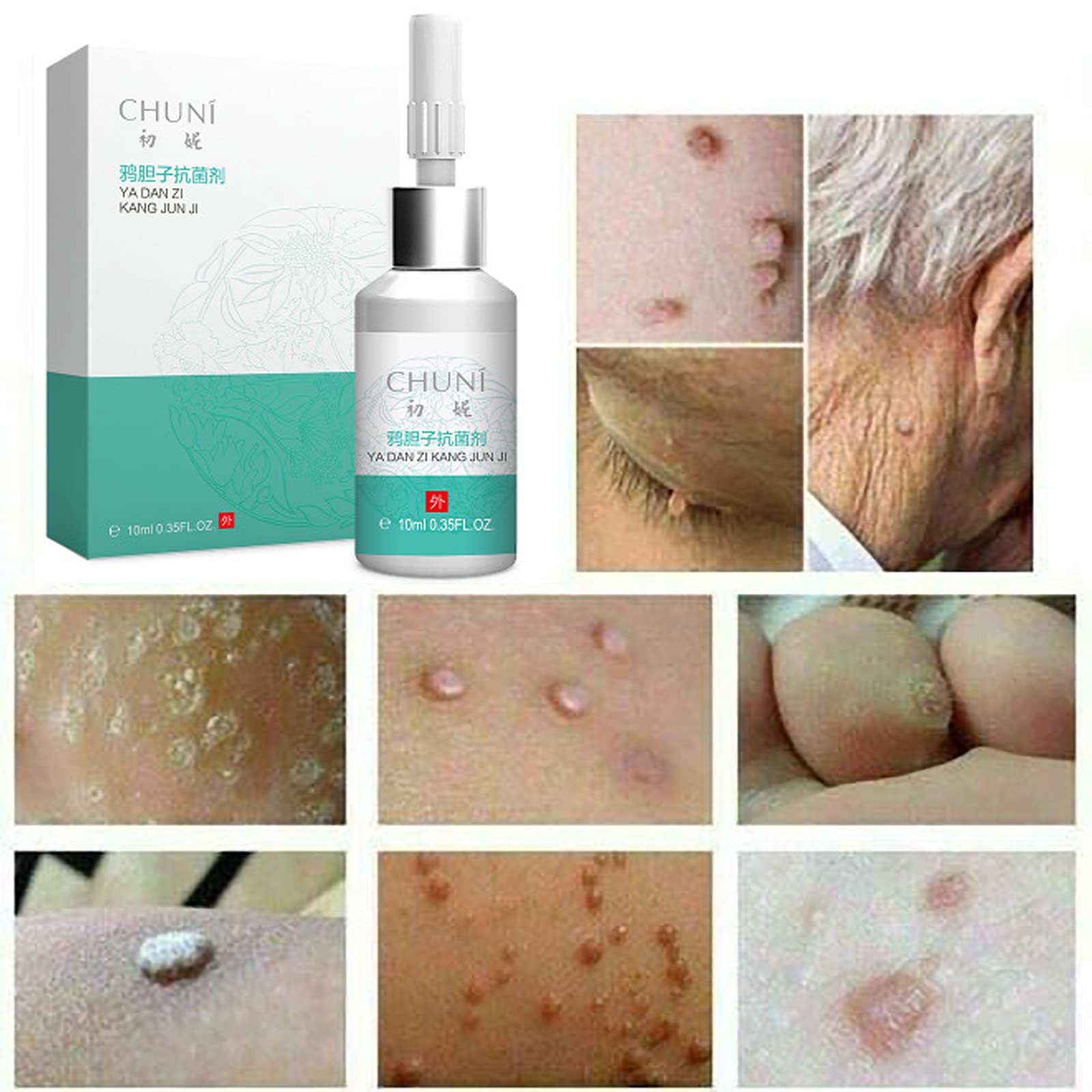 Buy 3 pcs Liquid Corn and Callus Remover Salicylic Equate Wart for