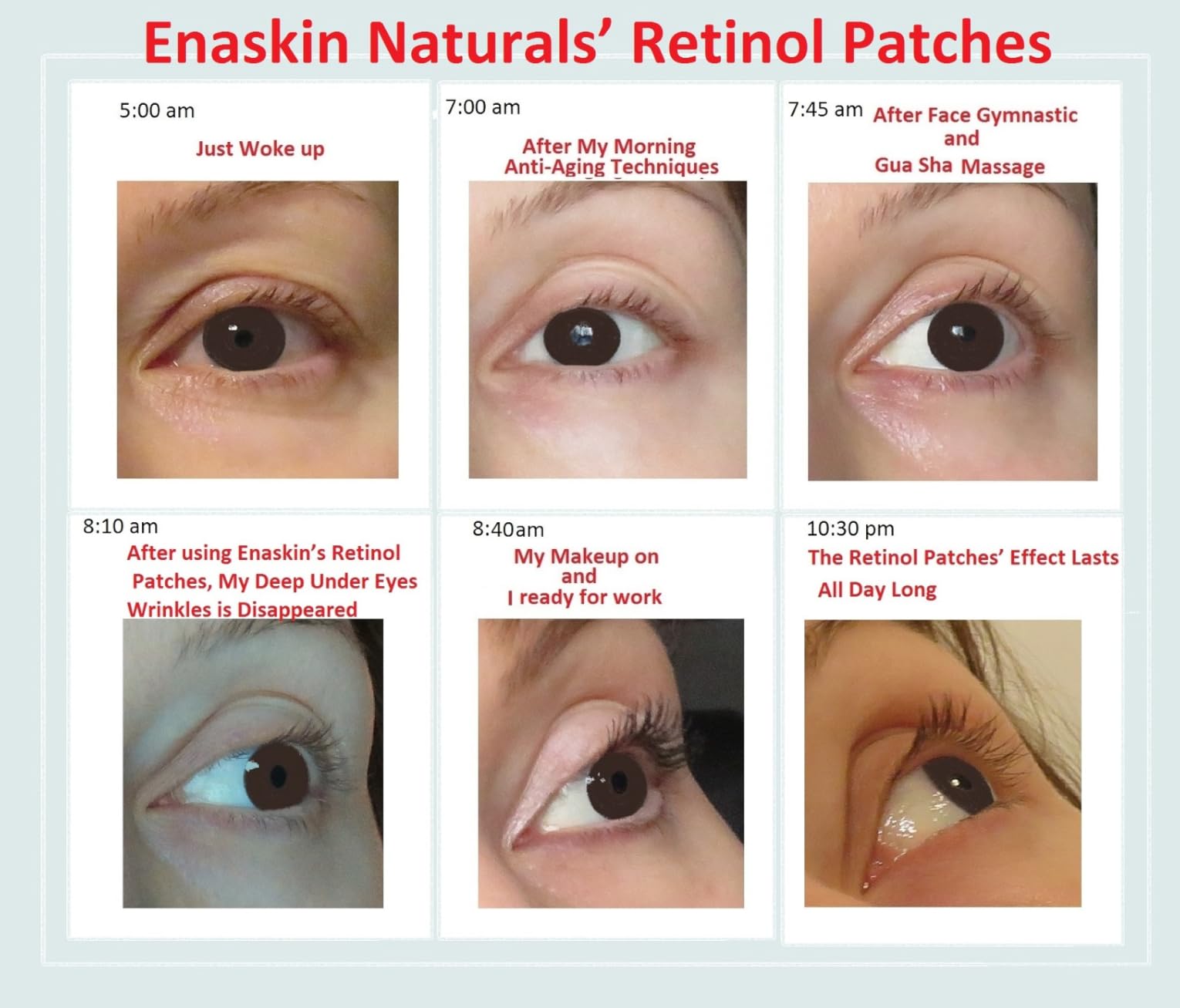 Enaskin Naturals Under Eye Patches for Dark Circles: 30 Pairs Retinol Collagen Eye Gels Mask - Reduce Wrinkles Puffy & Bags - Skin Treatment Pads - Anti Aging Moisturizer For Women (Blue)