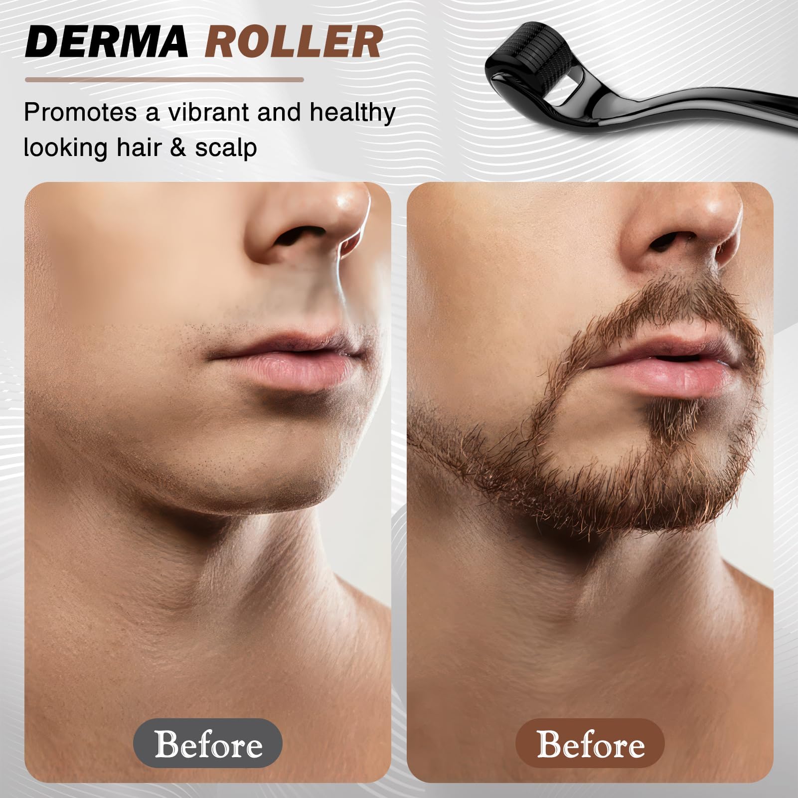 Dermaroller Capelli, Microneedling Derma Roller,Micro-Ago Roller 540-Aghi Rullo Derma per Crescita Dei Capelli,Trattamento di Perdita Capelli,Cicatrici da Acne e Smagliature,Delle Rughe(0,5 mm Nero)