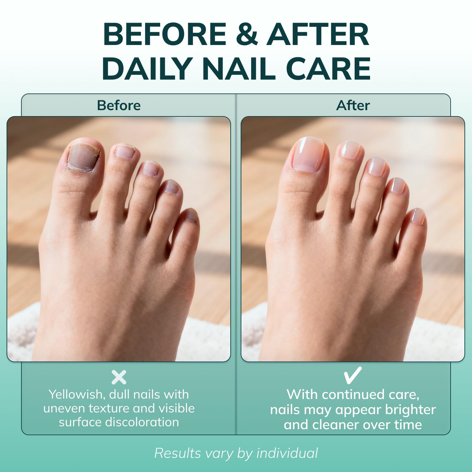 Swissker by Swissklip KlearNail Toenail Stick Nail Care Serum