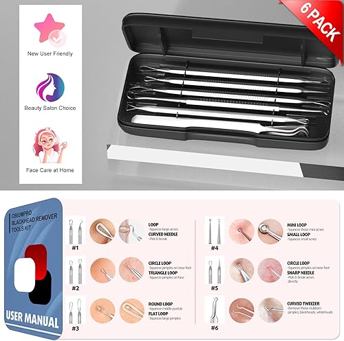 Miniatura 6 de Herramientas para eliminar puntos negros kit de herramientas para picapuñalar paquete de 6 comedones profesionales extractor de acné para manchas