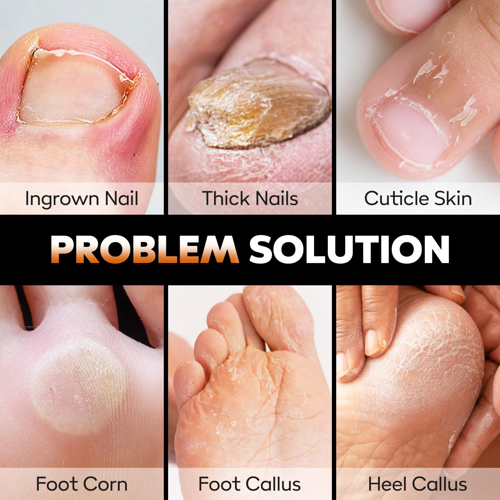 Coupe-Ongles de Précision pour Ongles Épais et Incarnés, Kit de 7 Pièces Podologique Professionnel, Outils de Pedicure et Soin des Pieds, Accessoires de Toilette en Acier Inoxydable Idéal pour Voyage