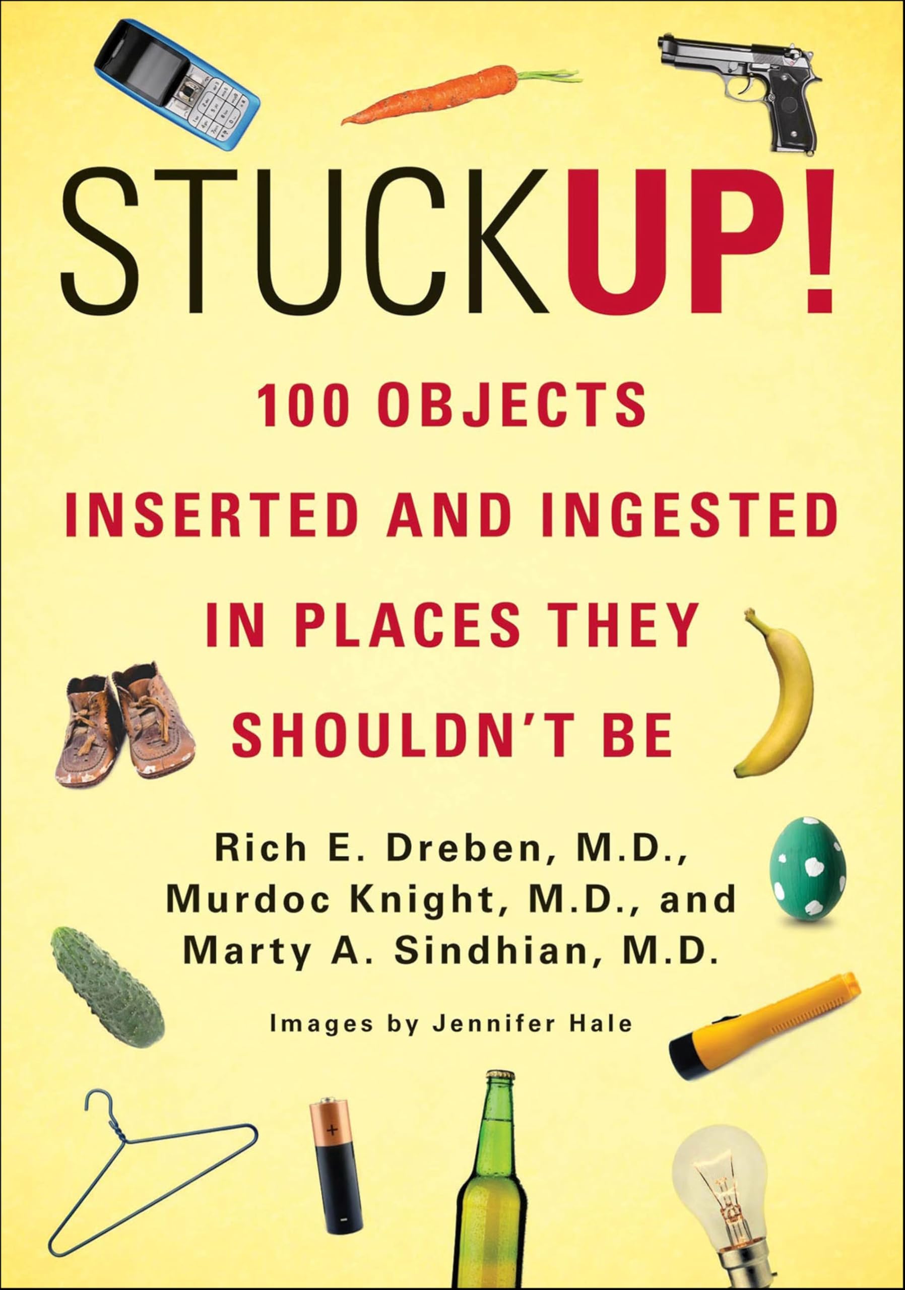 Stuck Up!: 125 Objects Inserted and Ingested in Places They Shouldn't Be