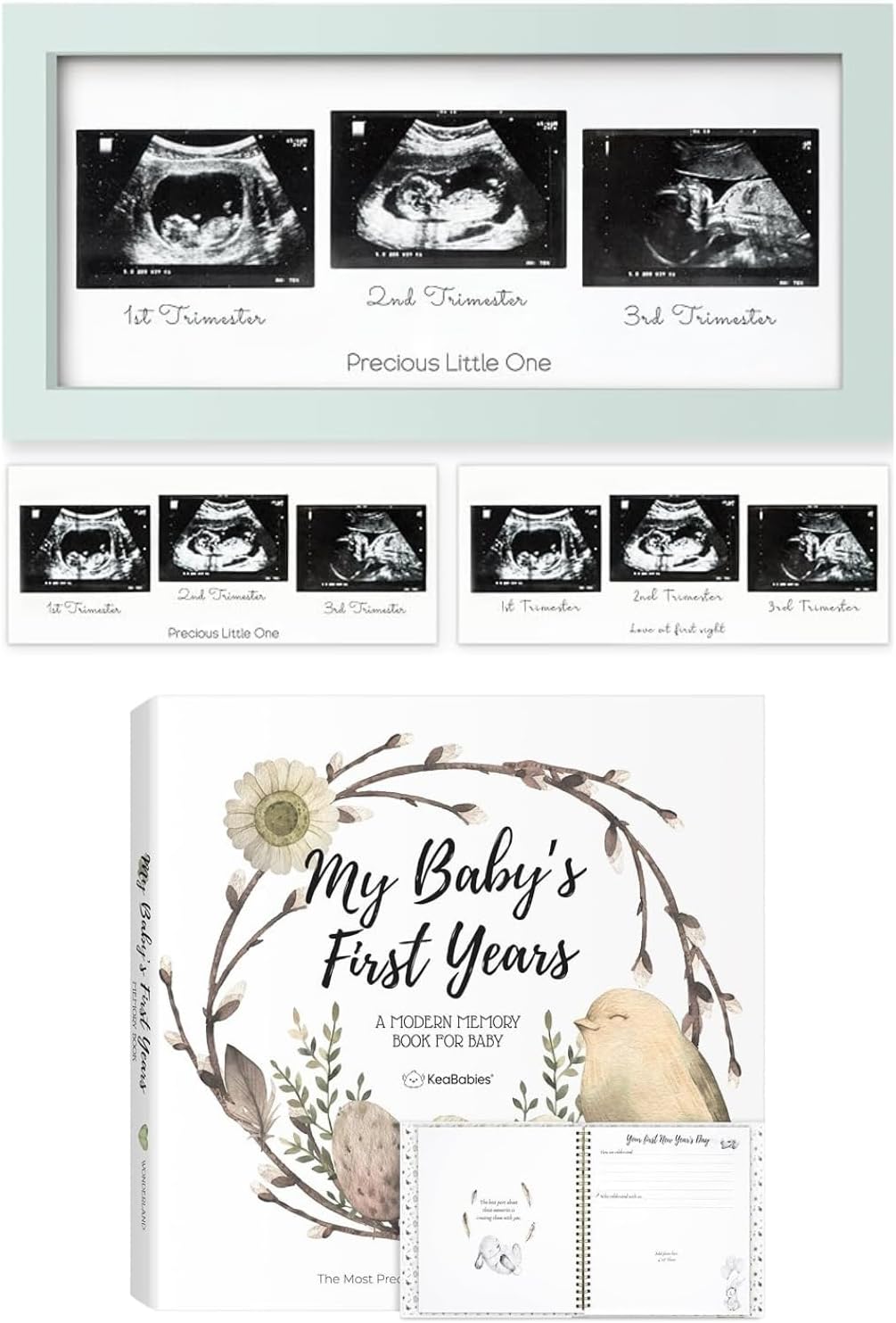 Keababies Sonogram Picture Frame and First 5 Years Baby Memory Book Journal - Trio Ultrasound Picture Frames For Mom To Be Gift - 90 Pages Hardcover First Year Keepsake Milestone Baby Book