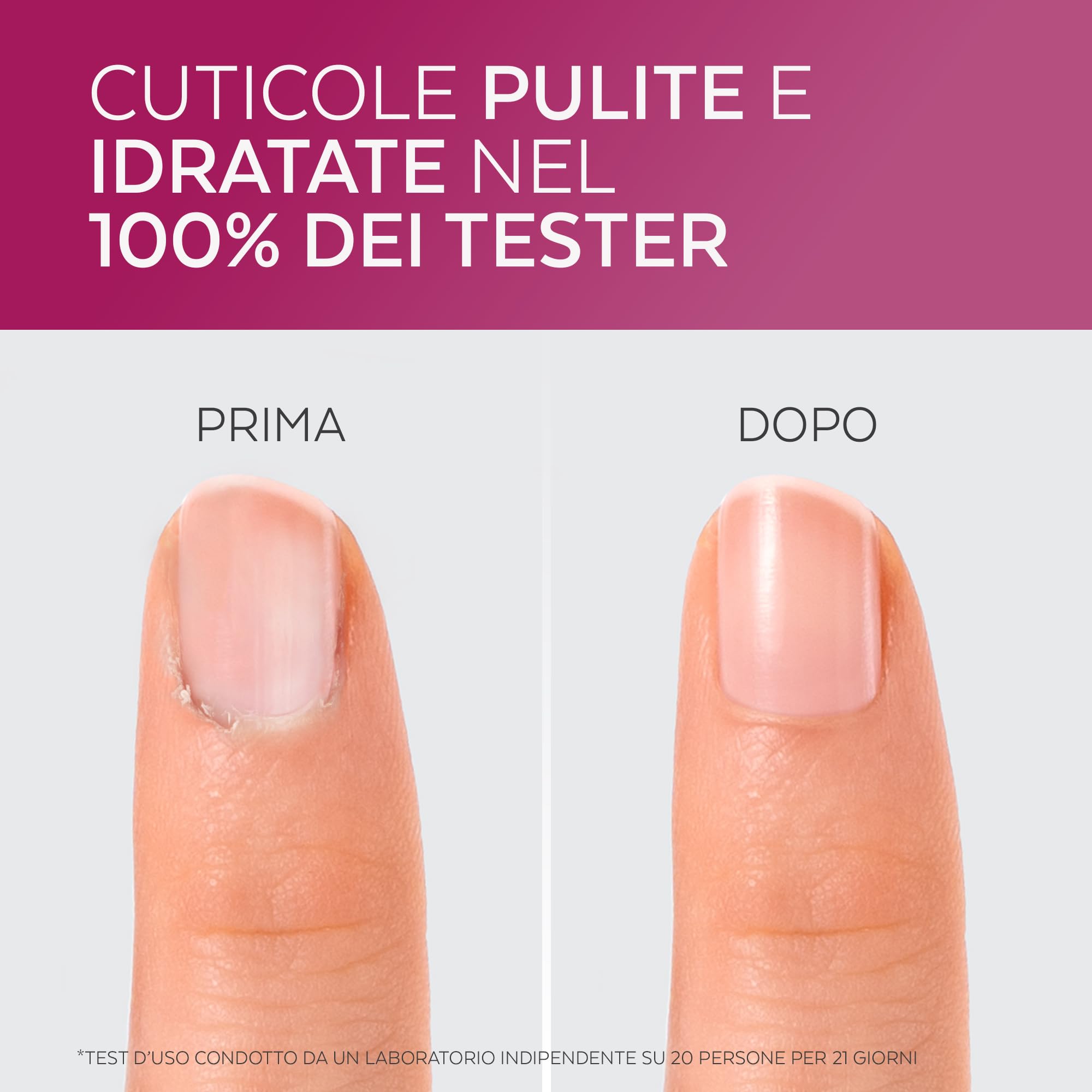 Poderm - Cuticole Remover 2-in-1 Esfolia e Idrata le Cuticole - Rimuove la Pella Morta - Rimuovi Cuticole Unghie - Cuticle Remover - Swiss Lab