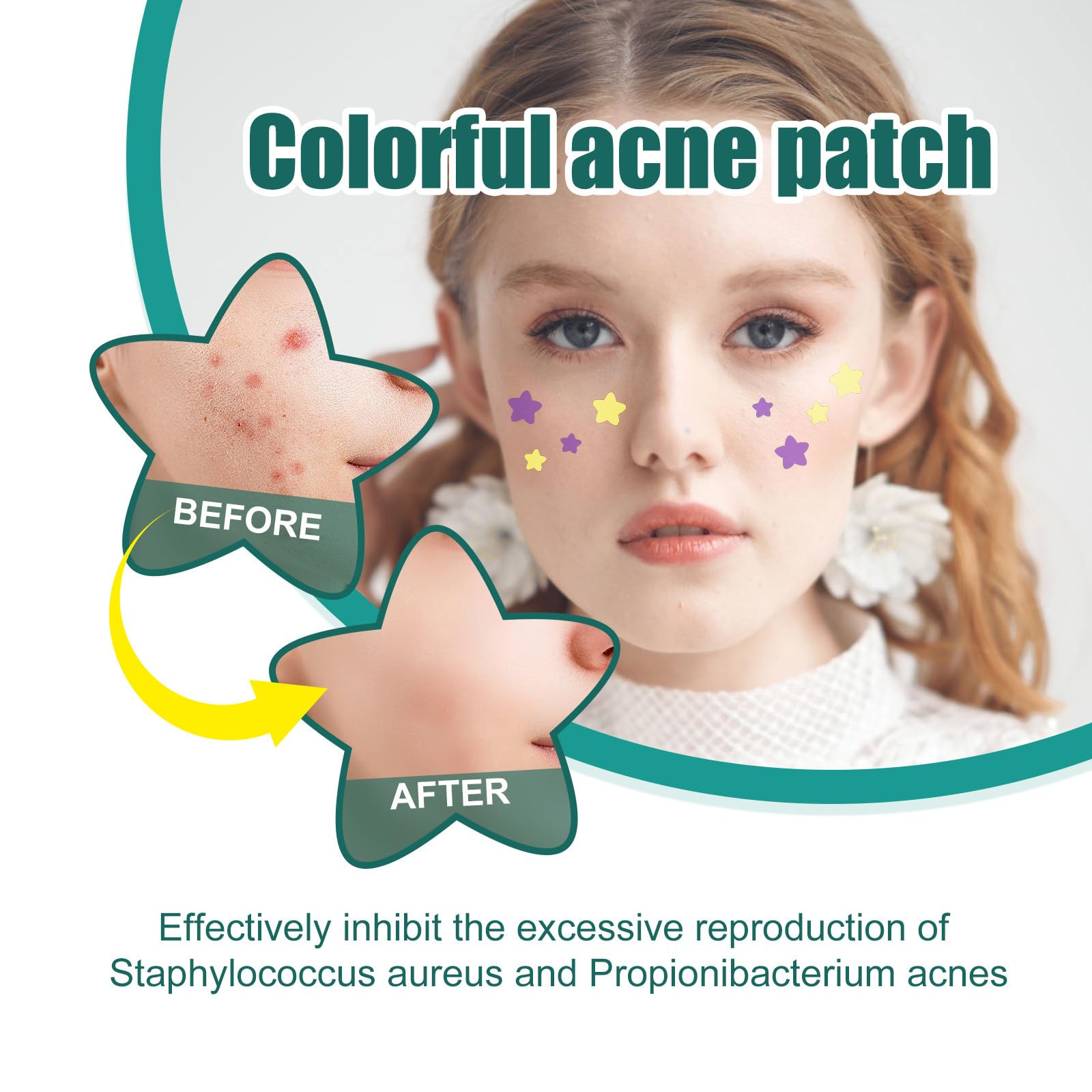 2 Acne Patch Star, Tea Tree Oil Spot Sticker, Water Colloidal Patch for Acne Flaws, and Facial Acne (112 dots, 8mm and 12mm) - Image 3