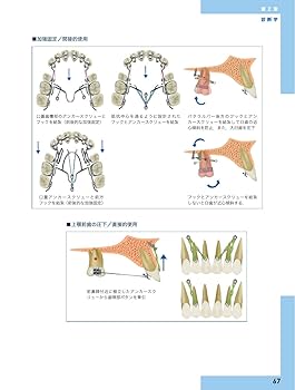 リンガルブラケット矯正の臨床 リンガルブランケット矯正の臨床 | 居波 徹, 佐奈 正敏, 相澤