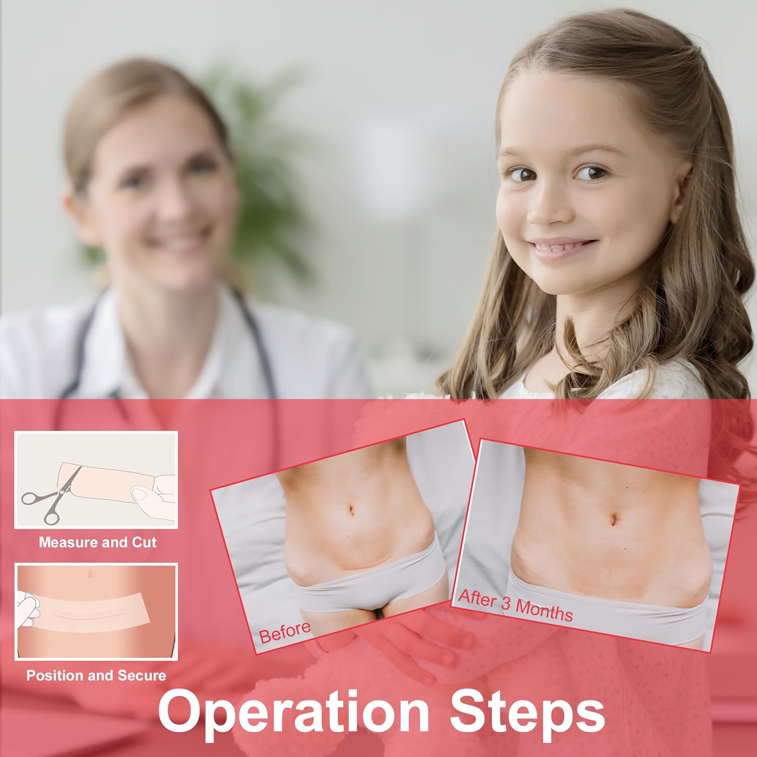 Silicone Scar Sheets 1.6”x 60”, Medical Grade Silicone Scar Tape, Reusable, Away Scar Treatment, Scar Removal Strips for Keloid, C-Section, Surgery, Burn, Acne - Image 6