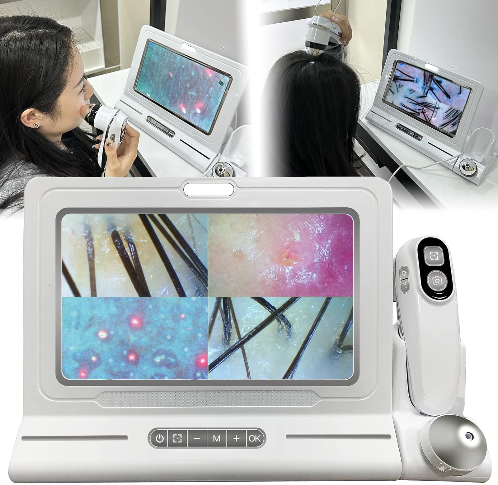 Skin & Scalp Analyzer, 11-Inch HD Portable Skin Diagnosis Hair Analyzer Machine with Dual Zoom (200x/50x), for Hair Salons & Beauty Clinics, Offers 4 Grid Comparison