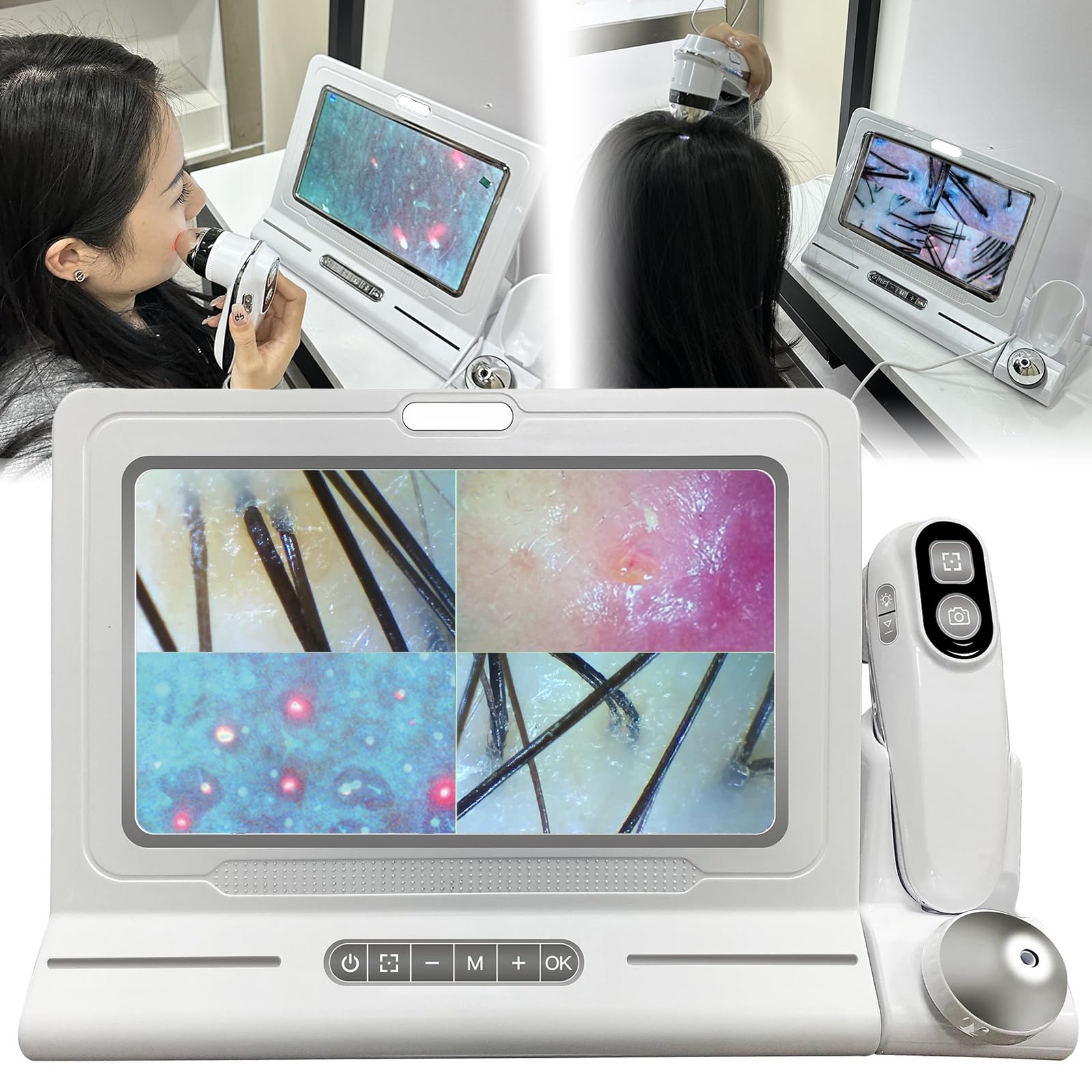 Skin & Scalp Analyzer, 11-Inch HD Portable Skin Diagnosis Hair Analyzer Machine with Dual Zoom (200x/50x), for Hair Salons & Beauty Clinics, Offers 4 Grid Comparison