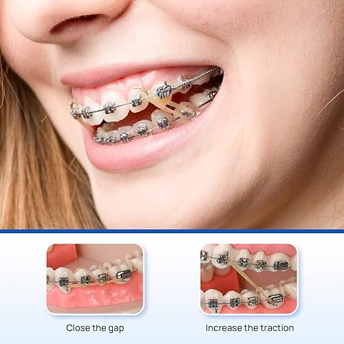 Miniatura 2 de JMU Bandas elásticas ortodónticas de goma, paquete de 100 bandas elásticas intraorales medianas 516, bandas elásticas dentales de látex fabricadas