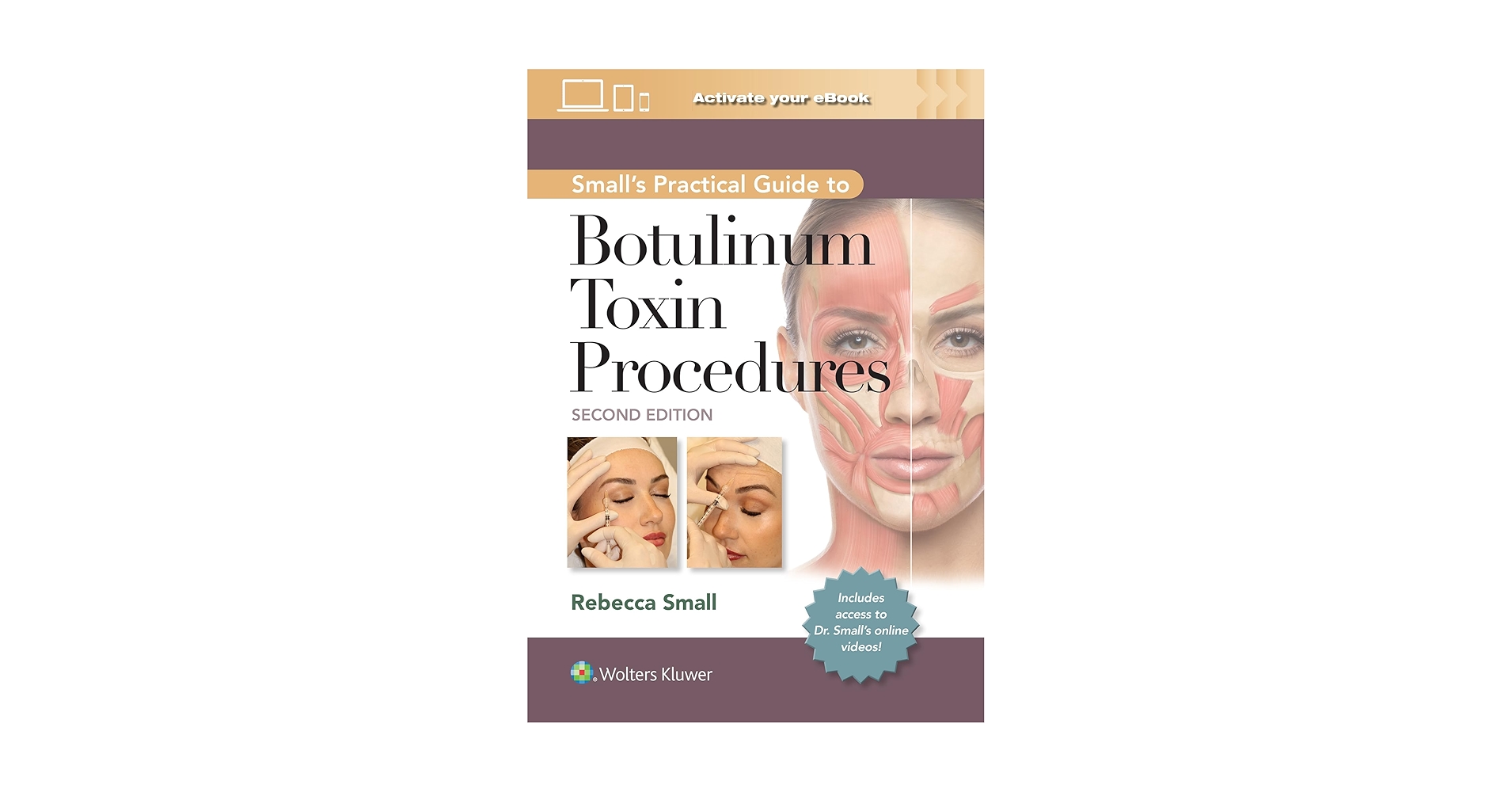 Small's Practical Guide to Botulinum Toxin Procedures: Print