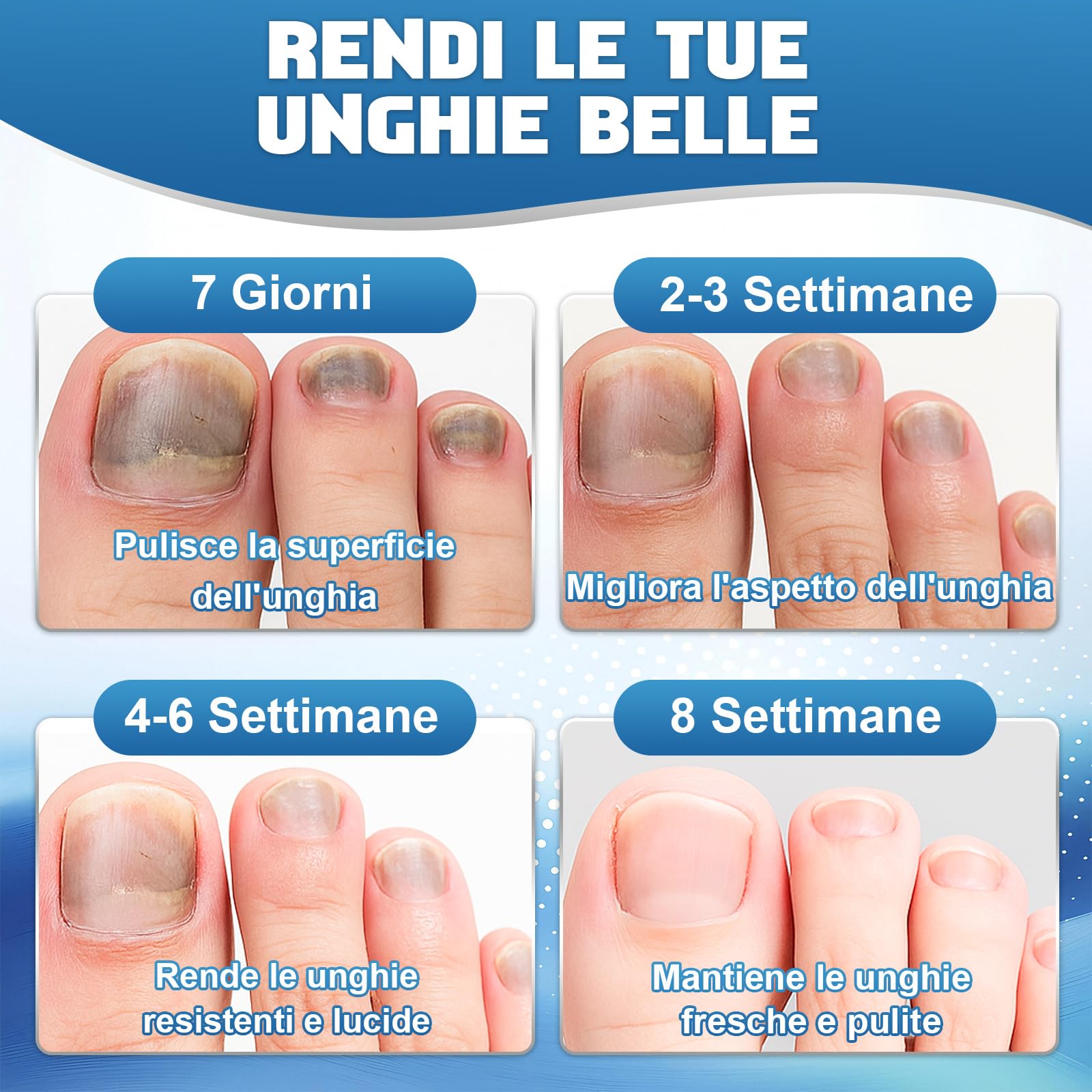 Micosi Unghie Piede, 30ml Liquido Antimicotico Unghie Piedi, Efficace Funghi Unghie Piedi con Pennello e Lima per Unghie Spesse, Ingiallite, Opache o Danneggiate