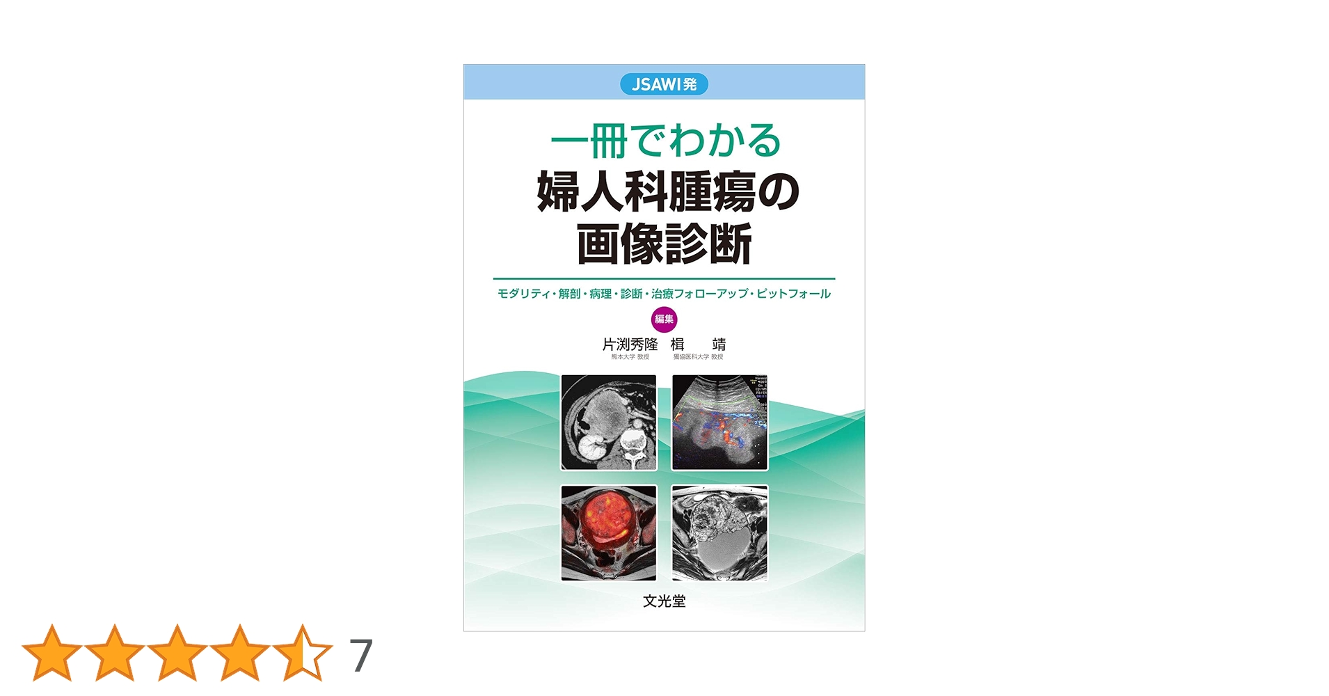 JSAWI発 一冊でわかる婦人科腫瘍の画像診断 | 片渕秀隆, 楫 靖