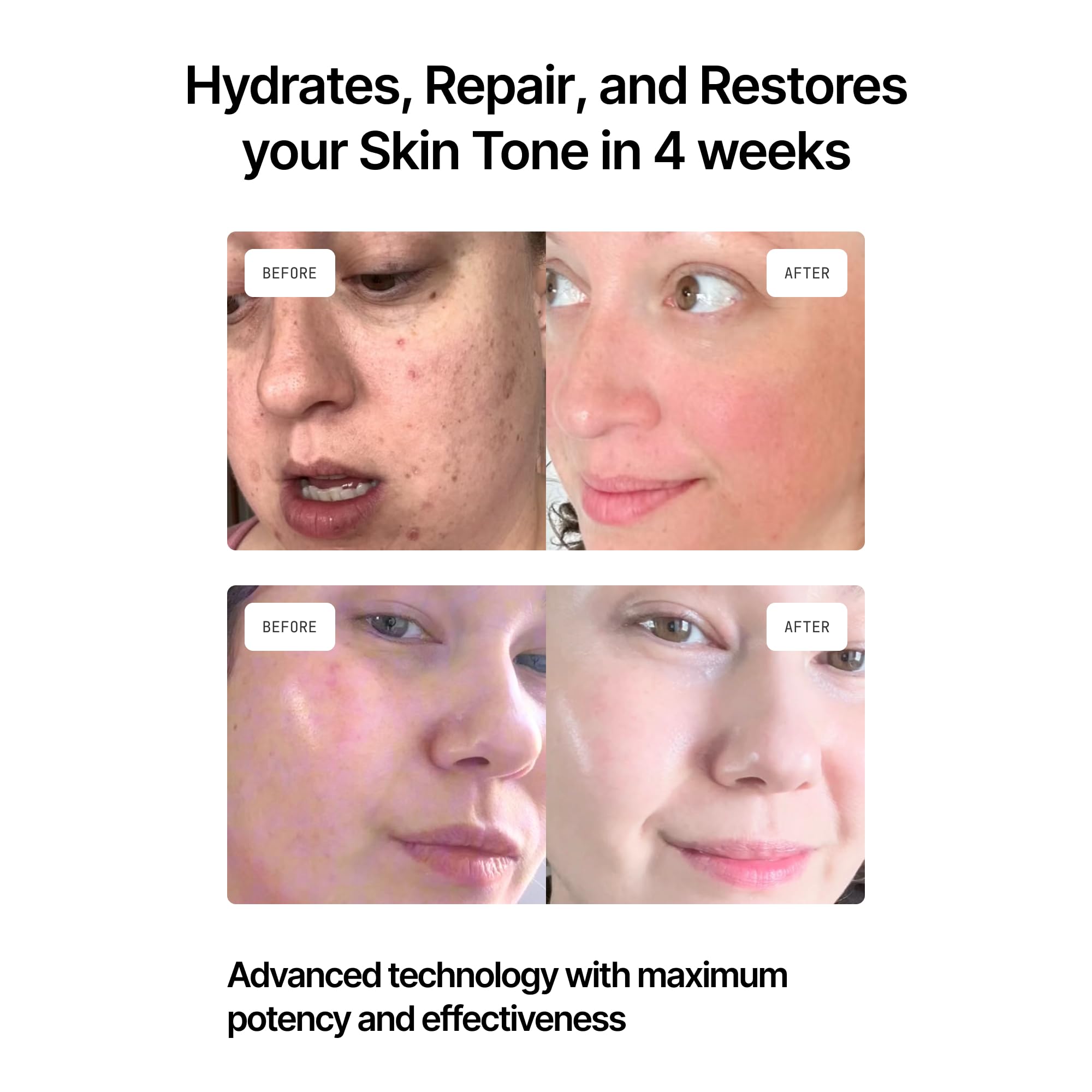Amazon.com: GENIX Beauty Face Cream - Anti-Aging, Anti-Wrinkle