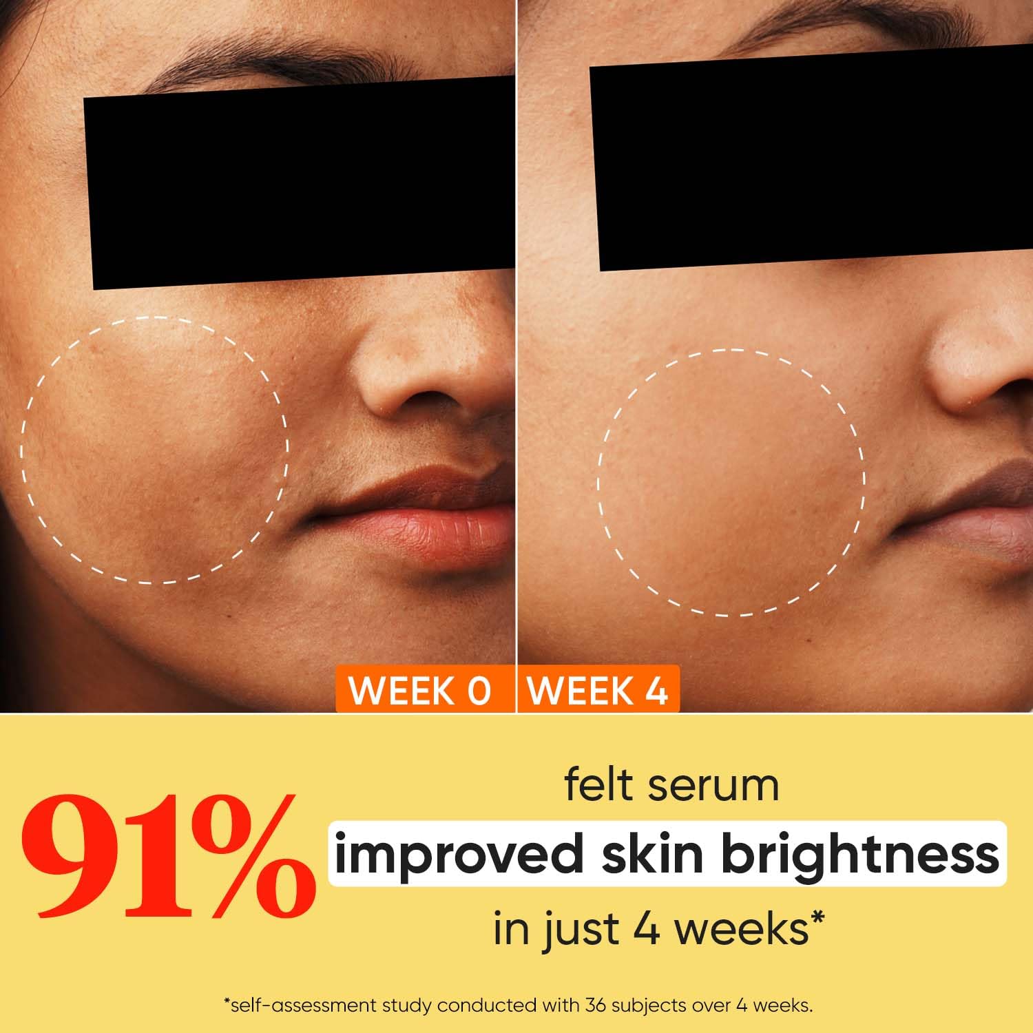 Dot & Key 10% Vitamin C + E, 5% Niacinamide Serum | Vitamin C Serum For Glowing Skin | Fades Dark Spots | Vit C Serum with Blood Orange & Pumpkin | For Uneven & Dull Skin | For All Skin Types | 30ml 3 7108PR5QysL. SL1500