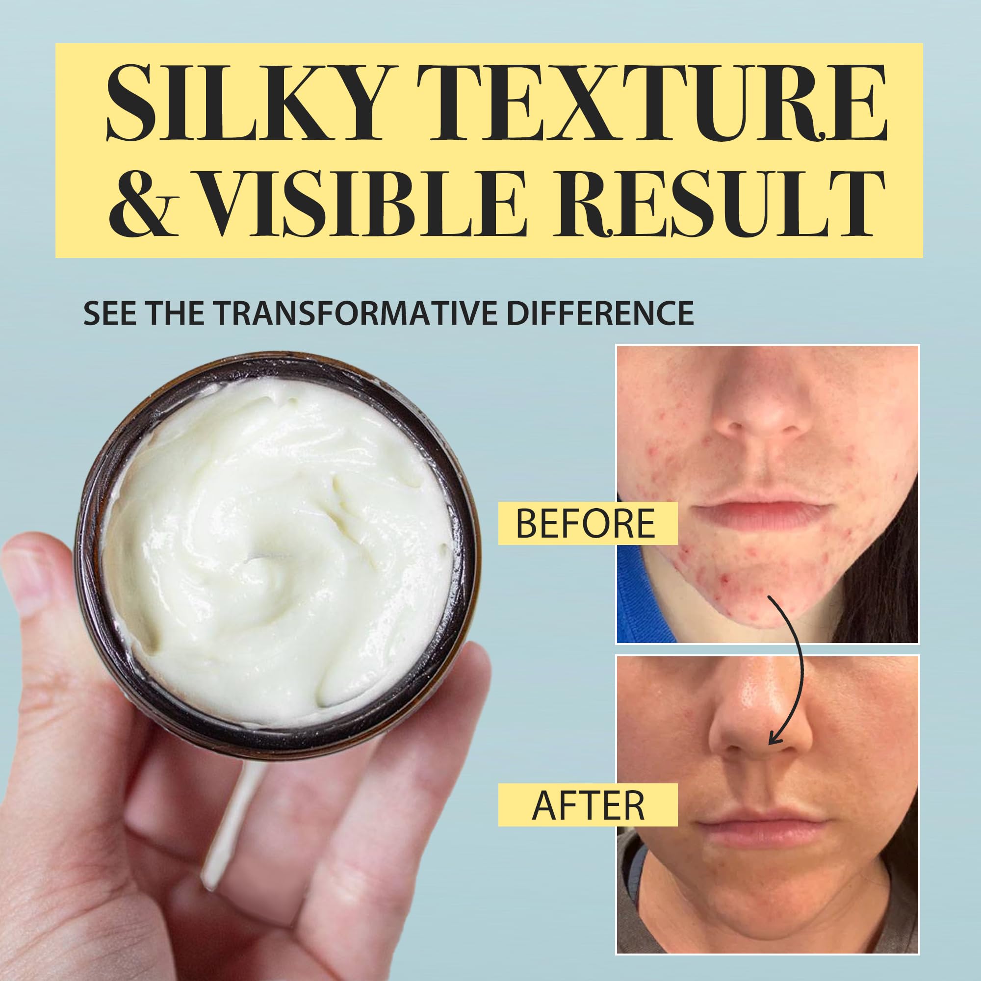 Beef Tallow Honey Balm for Skin:100% Grass-Fed Beef Tallow Moisturizer For Face and Body Vintage Tallow Balm With Olive Oil Manuka Honey For Sensitive Dry Skin Repair 2 oz - Image 4