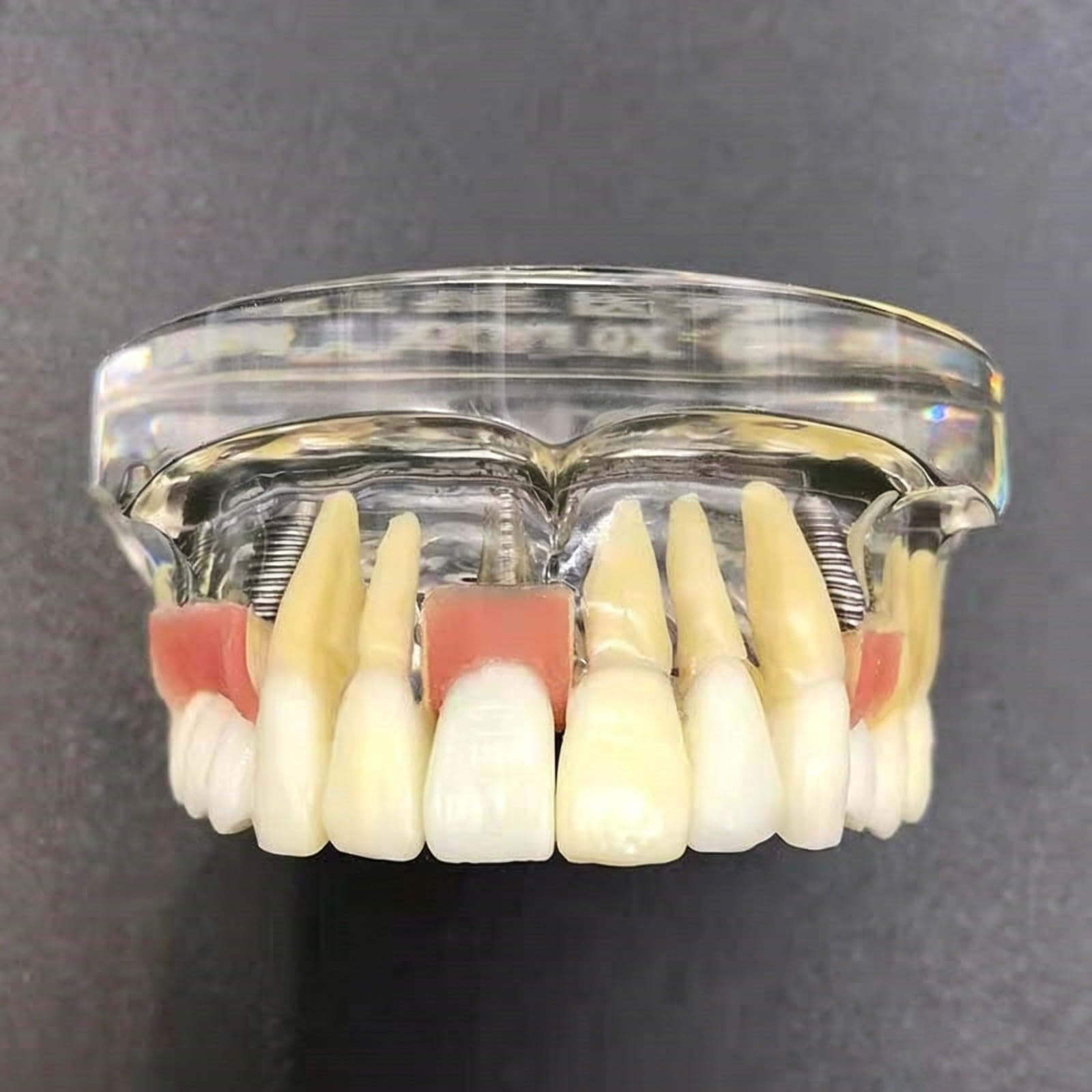 Modello di dente per restauro implantare, Dente Morbido e Bendable Modello dentali superiori con 4 denti superiori, dimostrazione con visione trasparente per studenti di odontoiatria e formazion