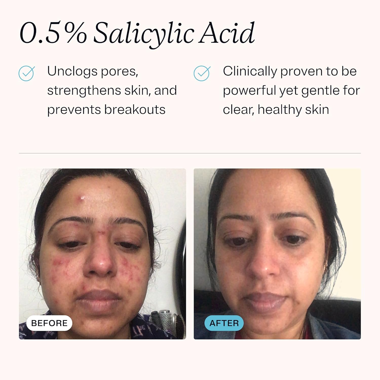 MDacne Hydrating Facial Cleanser with Salicylic Acid 0.5% - Acne Treatment with Plant-Based Ingredients to Remove Dirt & Oil, Protect Skin & Unclog Pores (2 Ounce (Pack of 1)) - Image 3