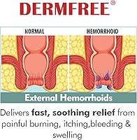 Vista 3 de Cuidado del ungüento para hemorroides, alivia instantáneamente la hinchazón, el dolor, la picazón y las molestias externas, ayuda a proteger