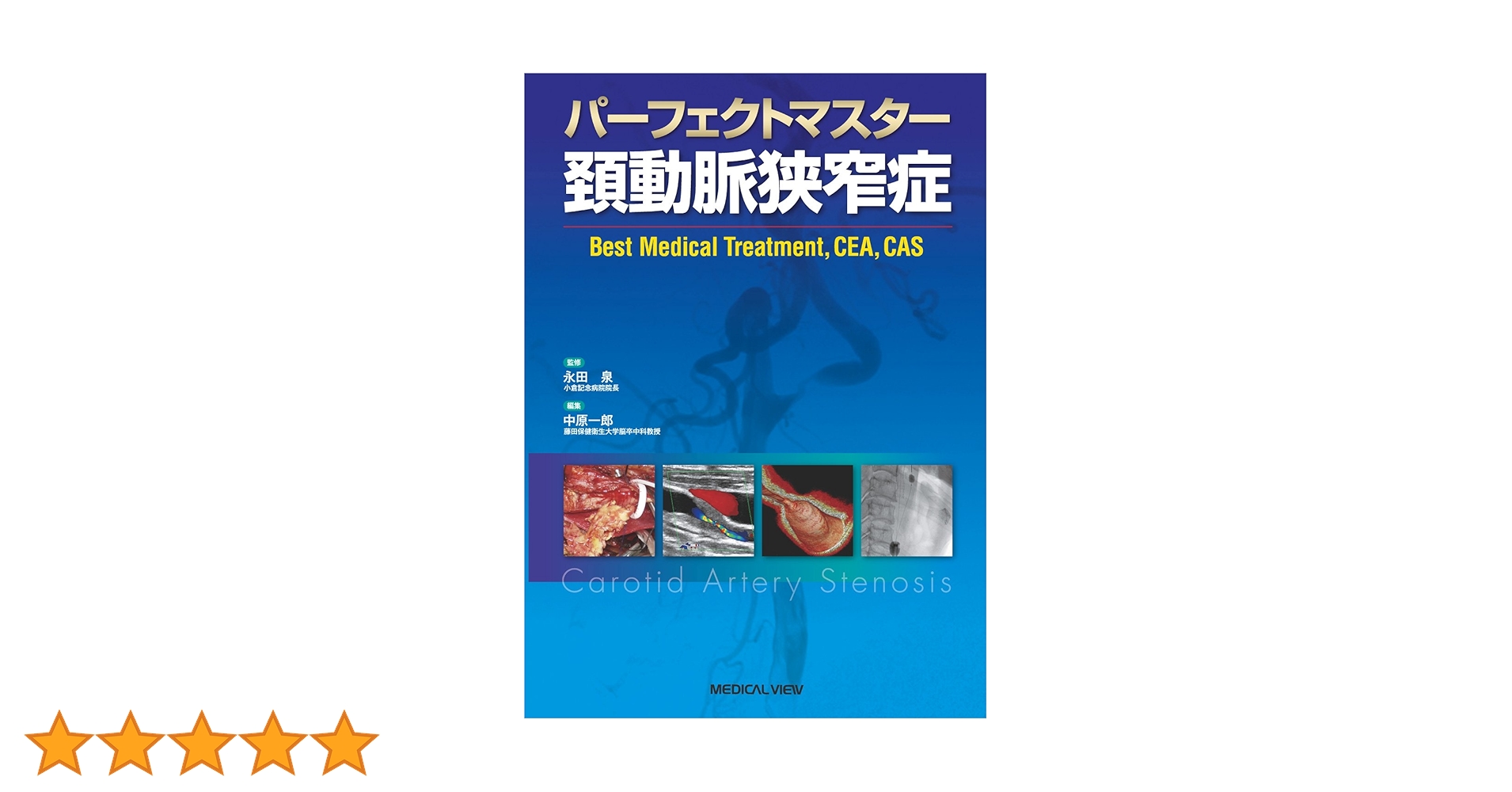 パーフェクトマスター 頚動脈狭窄症 メジカルビュー社｜脳神経外科｜パーフェクトマスター 頚動脈狭窄症