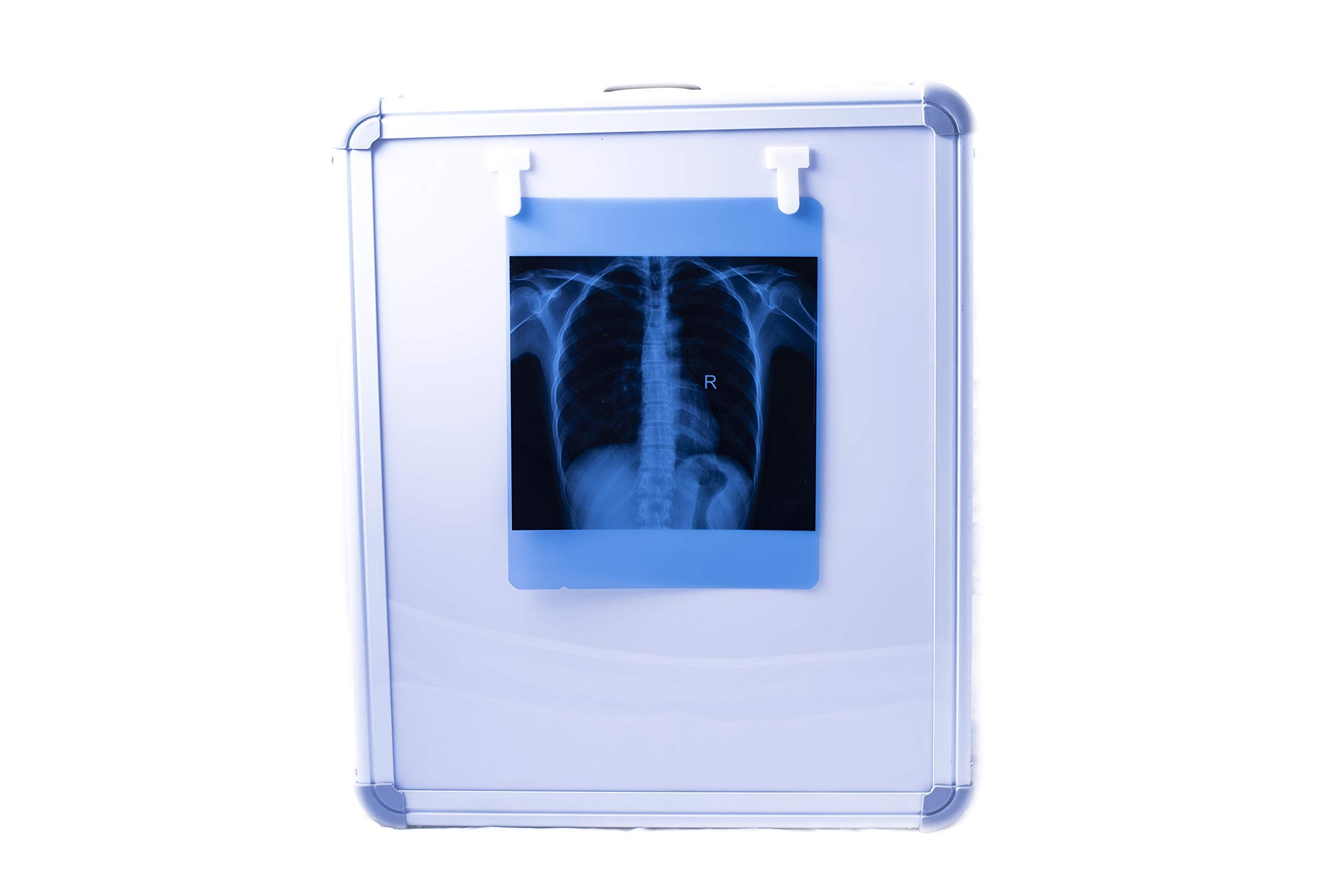 X-SHIELD Premium Single Screen LED X-Ray View Box with Automatic Film Activation (Single Section)