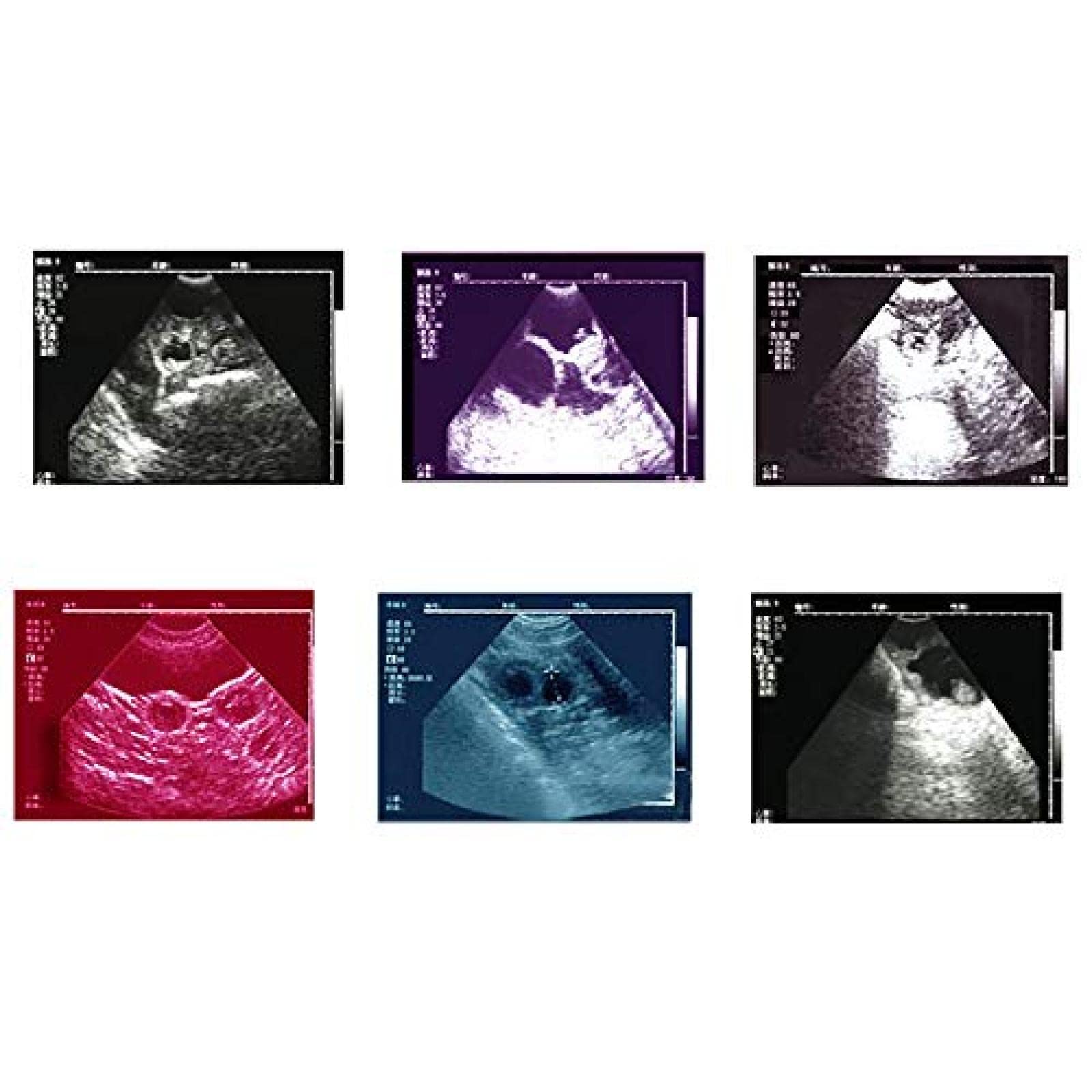 Scanner Portatile ad ultrasuoni, Tester di Gravidanza Veterinario ad ultrasuoni B, Dispositivo diagnostico a Colori con scansione a Ventola Meccanica da 3,5 MHz, utilizzato per l'ispezione d