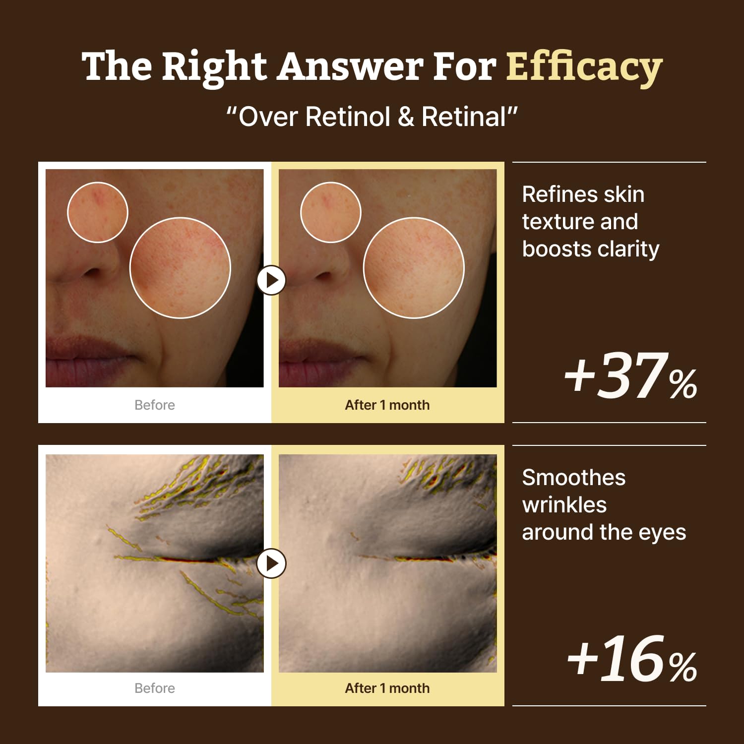 Dr. Reju-All Advanced Retino-Mela Serum – HPR Retinol Serum for Face – Anti-Aging, Pore Minimizer, Next-Gen Korean Skin care – Gentle & Beginner-Friendly – Niacinamide 10% & TXA 4% – 1 Fl Oz