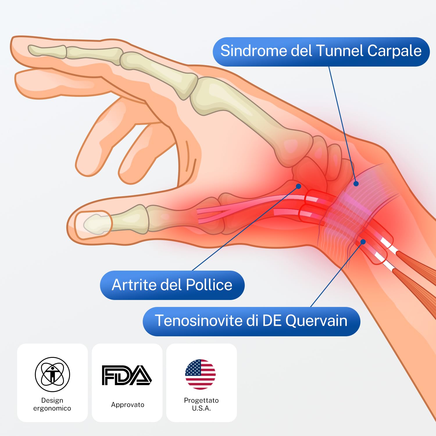 Fitomo Tutore Pollice, Tutore Tunnel Carpale 2 in 1 per Tenosinovite di De Quervains, Artrite, dito a Scatto, Tendinite, Sollievo dal Dolore del Tunnel Carpale e Distorsione del Pollice