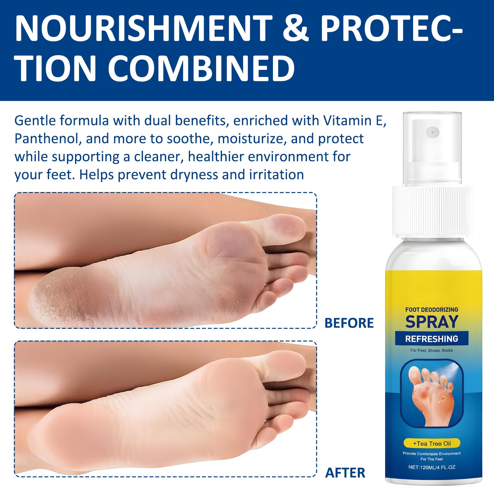 2 X 120 ML Spray Para Pies Aceite De Árbol De Té, Foot Spray, Desodorante-Para-Pies – Fórmula Con Aceite Natural De Árbol De Té Que Elimina El Mal Olor De Pies Y Protege La Salud De Los Mismos