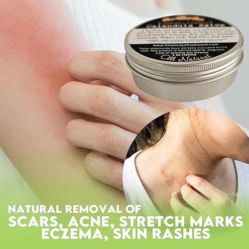 Miniatura 5 de Kimberlys Kupboard Caléndula Super Salve 3.8 fl oz3.8oz Piel seca calmante natural y eficaz bálsamo herbario  Multiusos picaduras de insectos,