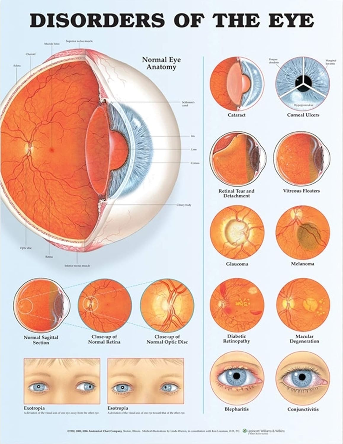 Disorders of the Eye Anatomical Chart      Poster – January 12, 2006