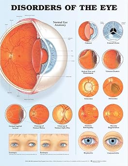 Disorders of the Eye Anatomical Chart