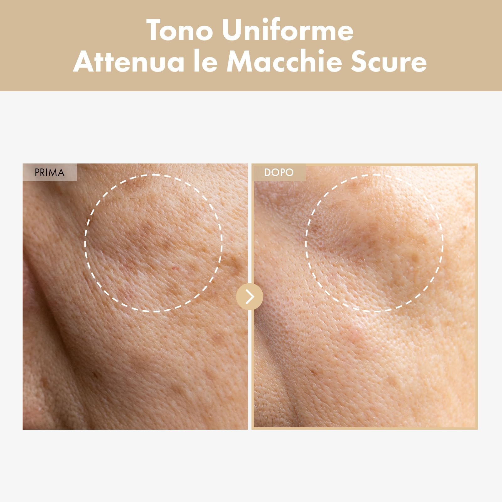 TOSOWOONG Tonico Lattiginoso Illuminante al Riso, 784.000ppm di Acqua di Riso Coreano, Niacinamide, Ceramidi, Panthenolo, Idratante, Senza Profumo, Skincare Coreana, 250ml