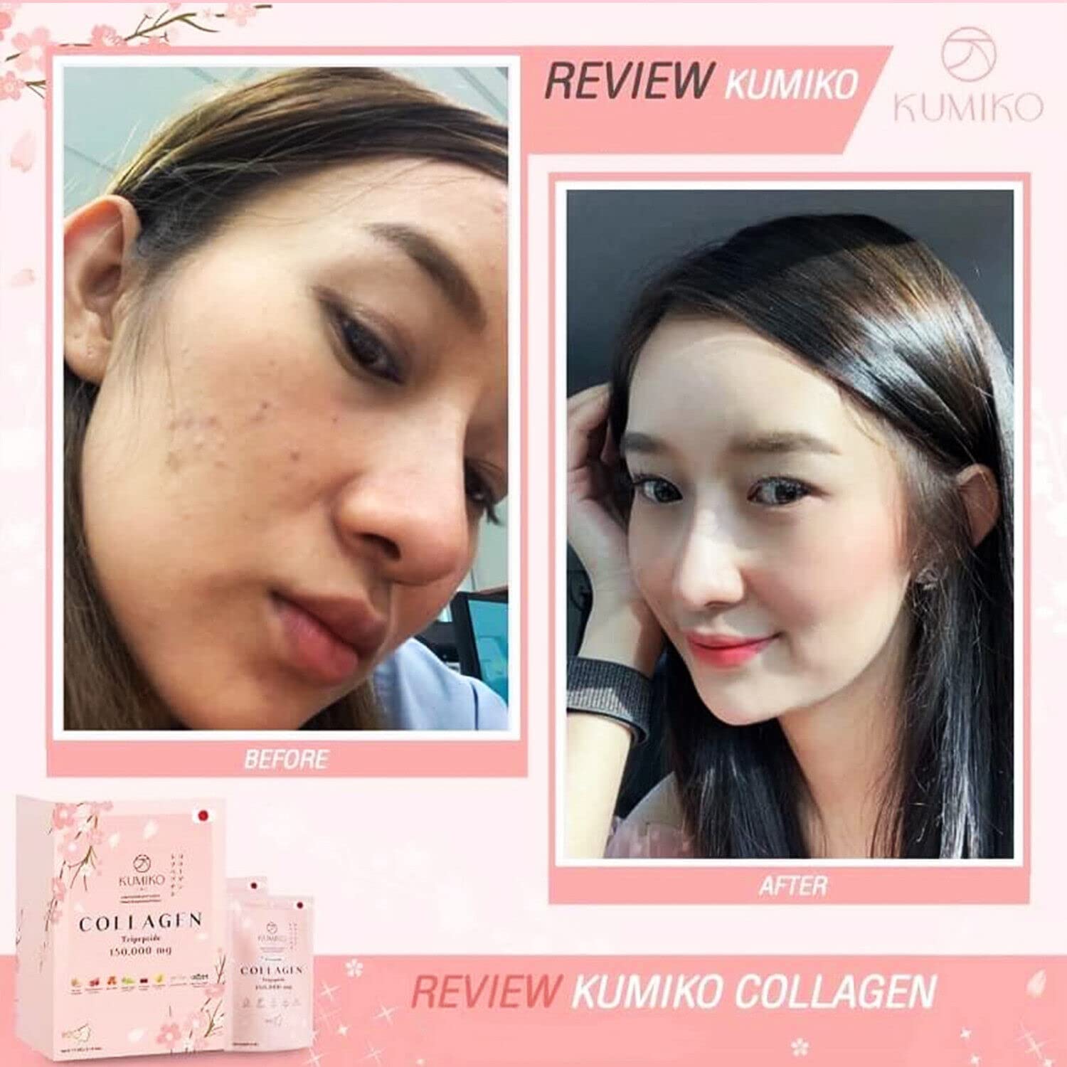 KUMIKO Collagen Tripeptide 150000mg Radiant Skin Natural Healthy Collagen Women Skin Care Nourishment Acne Blemishes Reduction Heals Dark Spot Organic Extract Supplement - Image 3