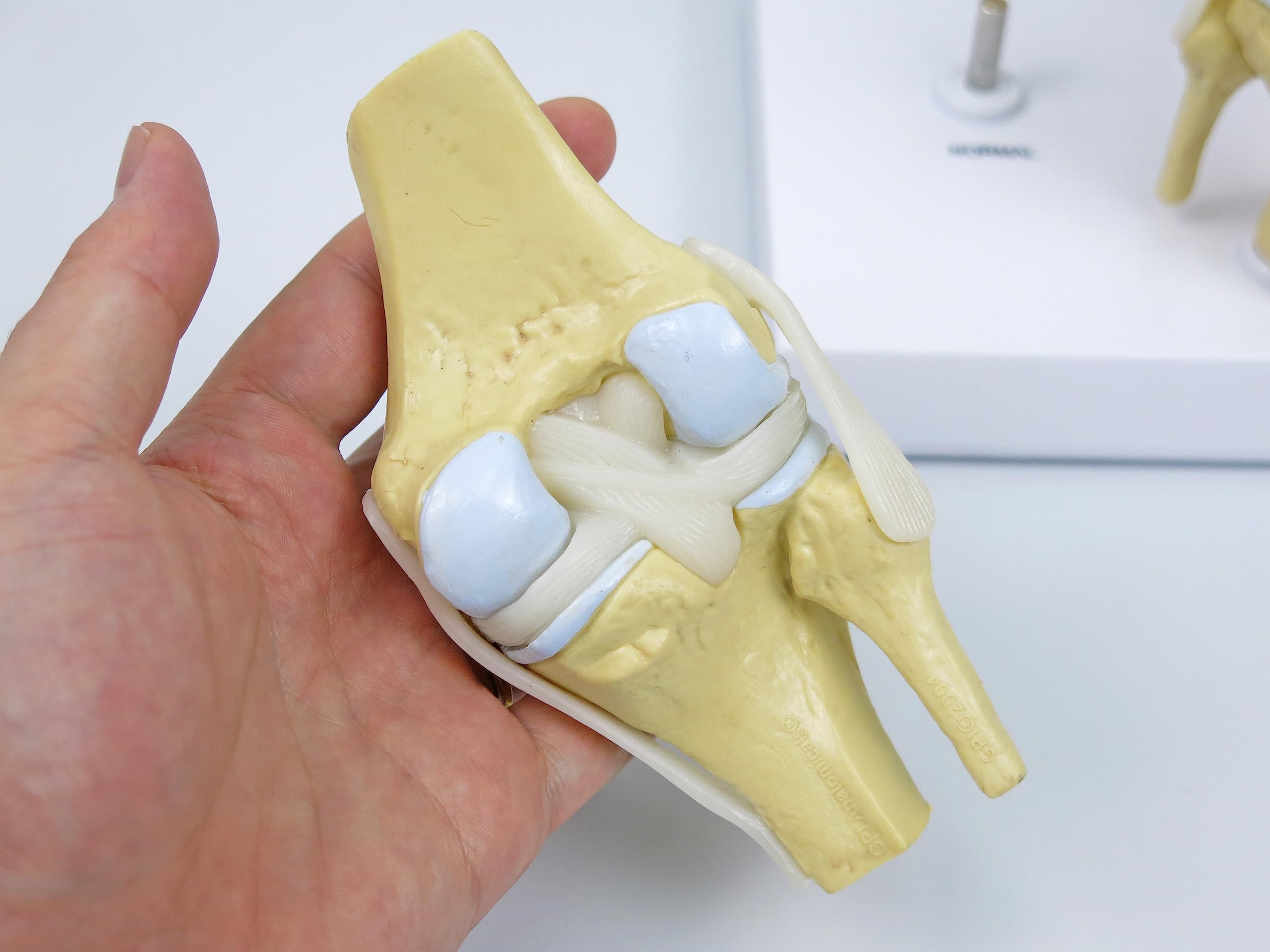 GPI Anatomicals 1100 Osteo-Kniemodellset 4 verschiedener Stadien