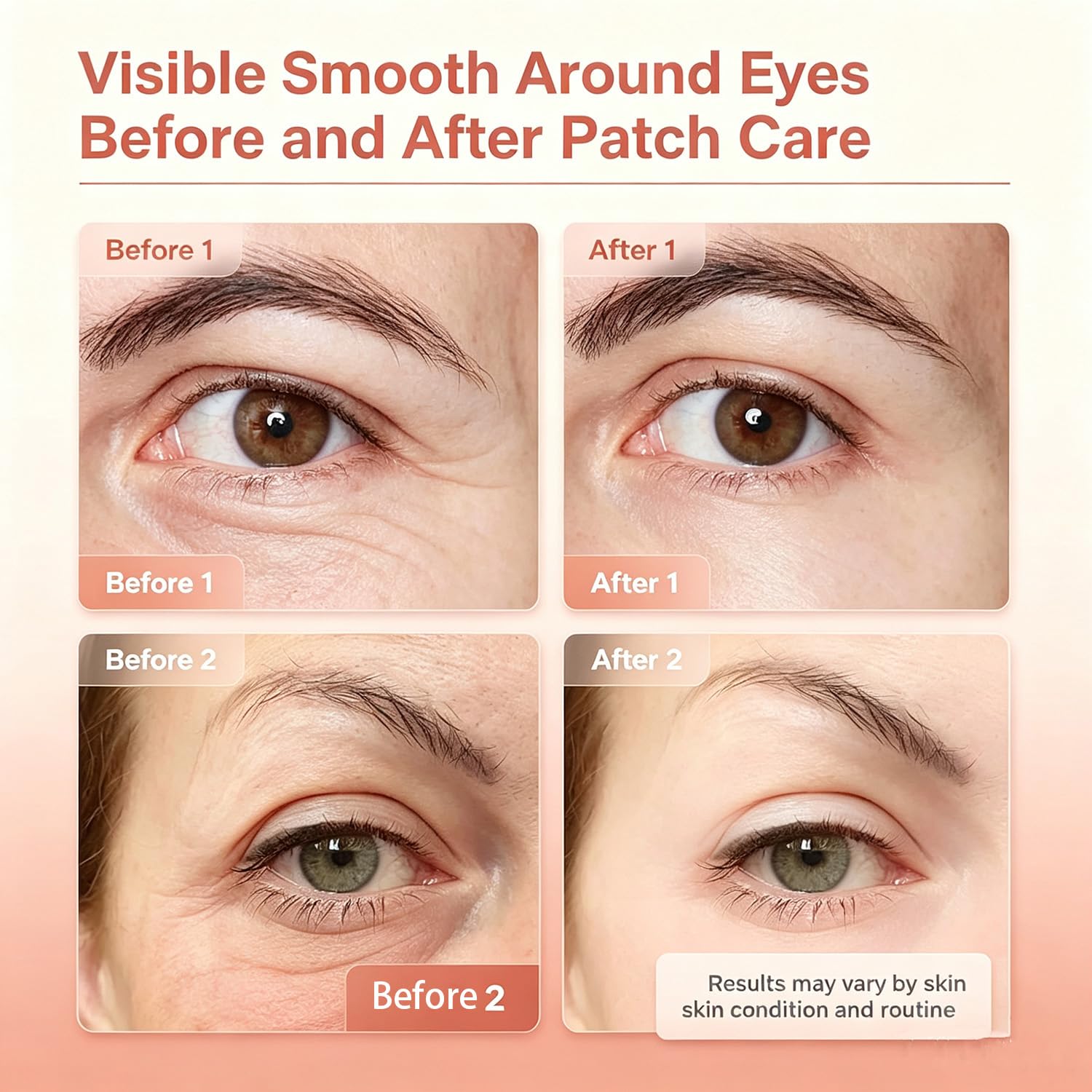 Micro Eye Patches, Under Eye Patch for Puffy Eyes and Dark Circles, Smile Line Patches, Forehead Hydrating Anti-Wrinkle Masks for Women